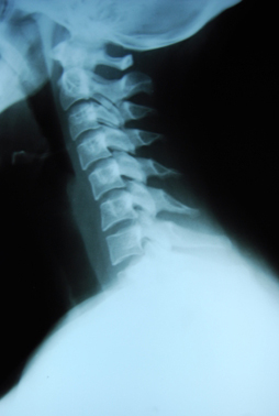 xray